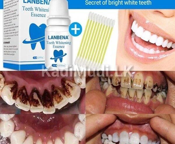 Teeth Whitening Kit – LANBENA