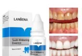 Teeth Whitening Kit – LANBENA